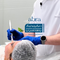 میکرونیدلینگ