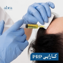 پی آر پی (PRP)