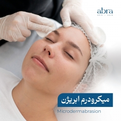 میکرودرم ابریژن
